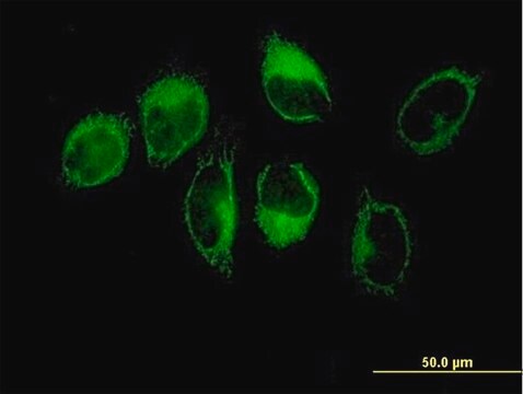 Anti-THBS1 antibody produced in mouse purified immunoglobulin, buffered aqueous solution