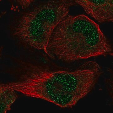 Anti-SLC33A1 antibody produced in rabbit Prestige Antibodies&#174; Powered by Atlas Antibodies, affinity isolated antibody