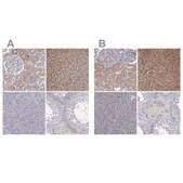 Anti-GSTO1 antibody produced in rabbit Prestige Antibodies&#174; Powered by Atlas Antibodies, affinity isolated antibody, buffered aqueous glycerol solution