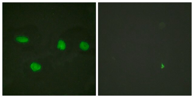 Anti-53BP1 antibody produced in rabbit affinity isolated antibody