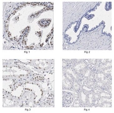 Anti-P40 Antibody, clone 11F12.1 clone 11F12.1, from mouse