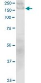 Monoclonal Anti-COL1A1 antibody produced in mouse clone 3G3, purified immunoglobulin, buffered aqueous solution