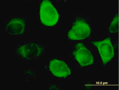 Monoclonal Anti-KRT18 antibody produced in mouse clone 1G8, purified immunoglobulin, buffered aqueous solution