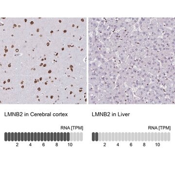 Anti-LMNB2 antibody produced in rabbit Prestige Antibodies&#174; Powered by Atlas Antibodies, affinity isolated antibody, buffered aqueous glycerol solution