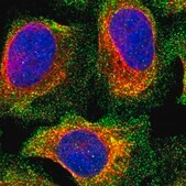 Anti-PPP3CC antibody produced in rabbit Prestige Antibodies&#174; Powered by Atlas Antibodies, affinity isolated antibody, buffered aqueous glycerol solution