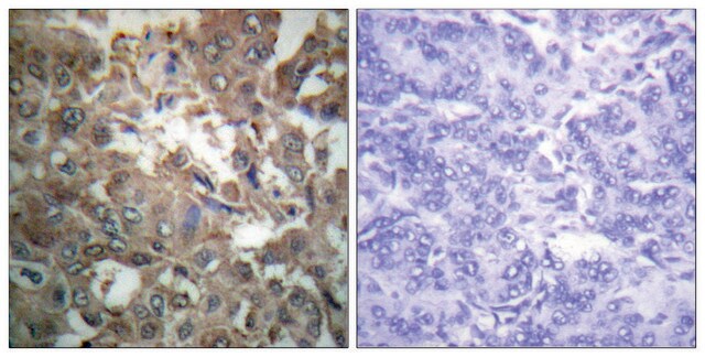 Anti-XPA antibody produced in rabbit affinity isolated antibody