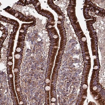 Anti-ANO10 antibody produced in rabbit Prestige Antibodies&#174; Powered by Atlas Antibodies, affinity isolated antibody, buffered aqueous glycerol solution