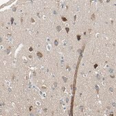 Anti-ROCK2 antibody produced in rabbit Prestige Antibodies&#174; Powered by Atlas Antibodies, affinity isolated antibody, buffered aqueous glycerol solution
