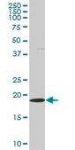 Monoclonal Anti-SKP1A, (C-terminal) antibody produced in mouse clone 2E6, purified immunoglobulin, buffered aqueous solution