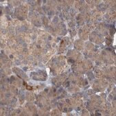 Anti-TSPOAP1 antibody produced in rabbit Prestige Antibodies&#174; Powered by Atlas Antibodies, affinity isolated antibody, buffered aqueous glycerol solution, Ab2