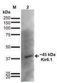 Monoclonal Anti-Kir6.1 antibody produced in mouse clone S366-60