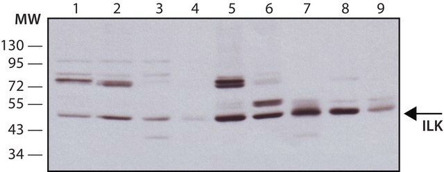 Monoclonal Anti-ILK antibody produced in mouse ~2&#160;mg/mL, clone 65.1, purified immunoglobulin, buffered aqueous solution