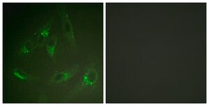 Anti-CSFR antibody produced in rabbit affinity isolated antibody