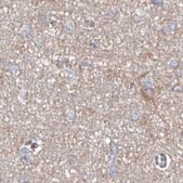 Anti-ASCC3 antibody produced in rabbit Prestige Antibodies&#174; Powered by Atlas Antibodies, affinity isolated antibody, buffered aqueous glycerol solution, ab1