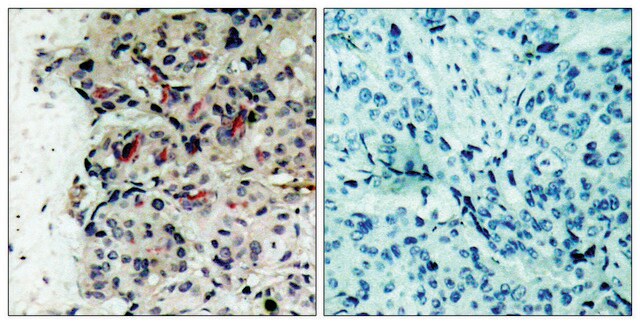 Anti-JAK1 antibody produced in rabbit affinity isolated antibody