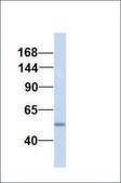 Anti-ABCC3 affinity isolated antibody