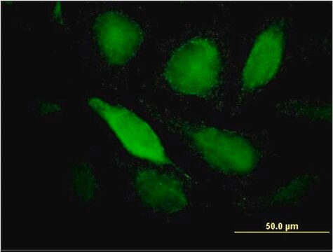 Monoclonal Anti-PTX3 antibody produced in mouse clone 2B10, purified immunoglobulin, buffered aqueous solution