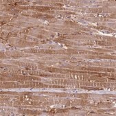 Anti-PRKAR1A antibody produced in rabbit Prestige Antibodies&#174; Powered by Atlas Antibodies, affinity isolated antibody, buffered aqueous glycerol solution