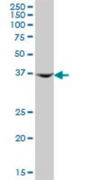 Anti-AMDHD2 antibody produced in mouse purified immunoglobulin, buffered aqueous solution