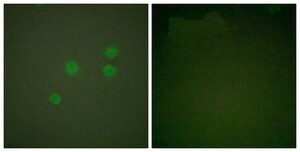 Anti-Cyclin E1 antibody produced in rabbit affinity isolated antibody