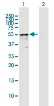 Anti-TRMT2B antibody produced in mouse purified immunoglobulin, buffered aqueous solution