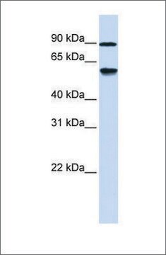 Anti-ADHFE1 antibody produced in rabbit affinity isolated antibody