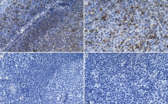 Anti-HLA-DPB1 Antibody, clone 1E16 ZooMAb&#174; Rabbit Monoclonal recombinant, expressed in HEK 293 cells