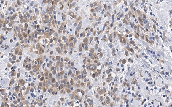 Anti-phospho-GSK-3&#945; Ser21 Antibody, clone 1E22 ZooMAb&#174; Rabbit Monoclonal recombinant, expressed in HEK 293 cells