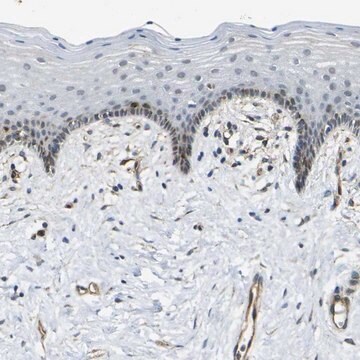 Anti-ECE1 antibody produced in rabbit Prestige Antibodies&#174; Powered by Atlas Antibodies, affinity isolated antibody, buffered aqueous glycerol solution