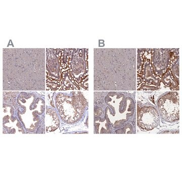 Anti-TMC5 antibody produced in rabbit Prestige Antibodies&#174; Powered by Atlas Antibodies, affinity isolated antibody, buffered aqueous glycerol solution