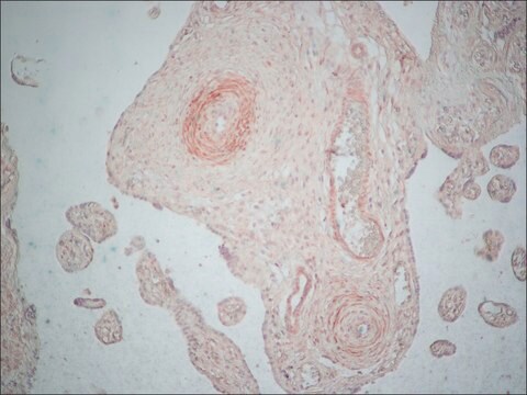 Monoclonal Anti-Caldesmon (Smooth) antibody produced in mouse clone hHCD, ascites fluid