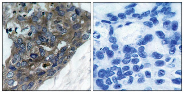 Anti-ASK1 antibody produced in rabbit affinity isolated antibody