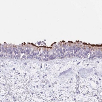 Anti-CPXM2 antibody produced in rabbit Prestige Antibodies&#174; Powered by Atlas Antibodies, affinity isolated antibody, buffered aqueous glycerol solution