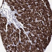 Anti-CPT1B antibody produced in rabbit Prestige Antibodies&#174; Powered by Atlas Antibodies, affinity isolated antibody, buffered aqueous glycerol solution