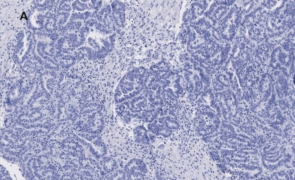 Anti-p53 Antibody, clone 6O23, ZooMAb&#174; Rabbit Monoclonal recombinant, expressed in HEK 293 cells