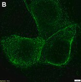 Anti-CFTR Antibody, clone MM13-4 ZooMAb&#174; Mouse Monoclonal recombinant, expressed in HEK 293 cells