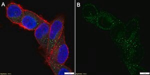 Anti-AGTR1 Antibody, clone 1I12 ZooMAb&#174; Rabbit Monoclonal recombinant, expressed in HEK 293 cells