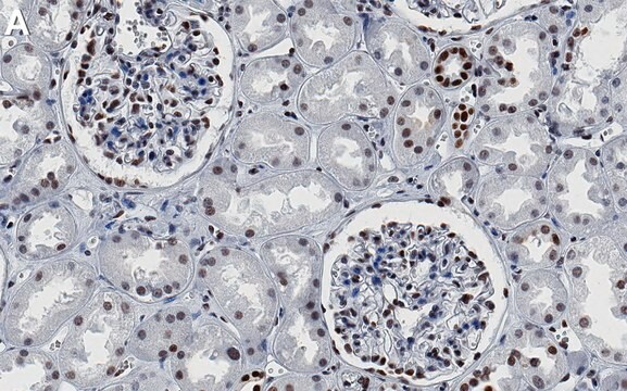 Anti-HSF1 Antibody, clone 1J20 ZooMAb&#174; Rabbit Monoclonal recombinant, expressed in HEK 293 cells