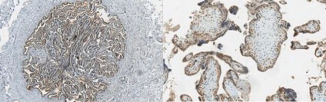 Anti-Mucin-9 Antibody, clone 7E10 clone 7E10, from mouse
