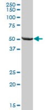 Anti-ALDH7A1 antibody produced in mouse IgG fraction of antiserum, buffered aqueous solution