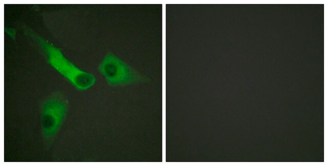 Anti-CASP9 antibody produced in rabbit affinity isolated antibody