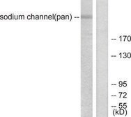 Anti-SODIUM CHANNEL-PAN antibody produced in rabbit affinity isolated antibody