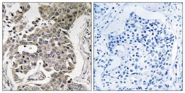 Anti-PPP2R1B antibody produced in rabbit affinity isolated antibody