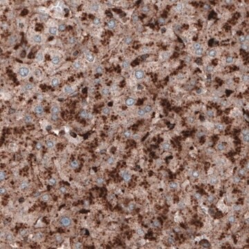 Monoclonal Anti-LAMP1 antibody produced in mouse Prestige Antibodies&#174; Powered by Atlas Antibodies, clone CL3484, purified immunoglobulin, buffered aqueous glycerol solution