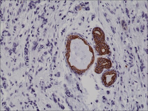 Anti-Cytokeratin-7antibody, Rabbit Monoclonal recombinant, expressed in HEK 293 cells, clone RM284, purified immunoglobulin