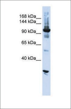 Anti-DIS3 antibody produced in rabbit affinity isolated antibody