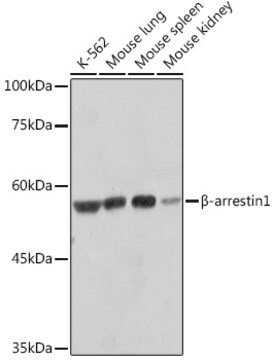 Anti-&#946;-arrestin1 Antibody, clone F7C2, Rabbit Monoclonal