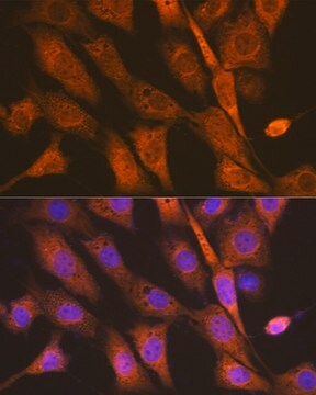 Anti-PEN2/PSENEN Antibody, clone 6J5O4, Rabbit Monoclonal