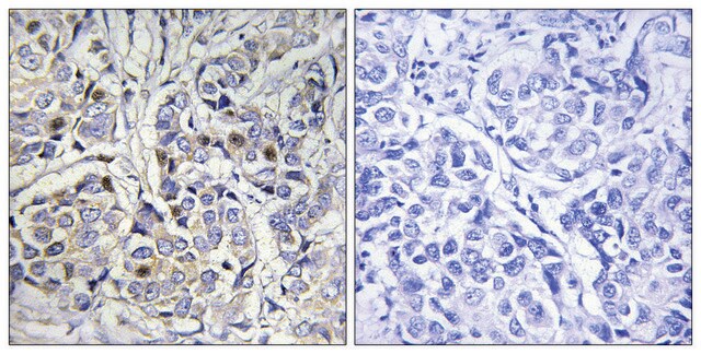 Anti-Centromeric Protein A antibody produced in rabbit affinity isolated antibody