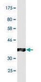Monoclonal Anti-ABCC2 antibody produced in mouse clone 2H6, purified immunoglobulin, buffered aqueous solution
